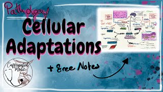 Cellular Adaptations Pathology Hypertrophy Hyperplasia Metaplasia Dysplasia and Neoplasia [upl. by Princess82]