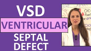 Ventricular Septal Defect Nursing  NCLEX Pediatric Congenital Heart Defects [upl. by Gnes]