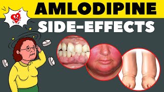 Amlodipine Side Effects amp How to Avoid  Amlodipine Adverse Effects [upl. by Desiri]