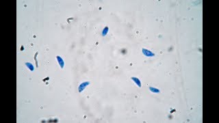 Toxoplasma gondii  live trophozoites [upl. by Dorris]