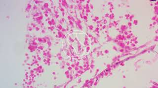 Coccidioides immitis under the microscope with GMSHaematoxylin and Eosin stain [upl. by Ssitruc]