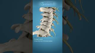 What is Cervical Degenerative Disc Disease Shorts [upl. by Jacquet]