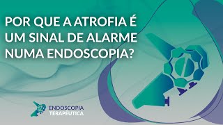 Por que a atrofia é um sinal de alarme numa endoscopia [upl. by Ahsiem63]