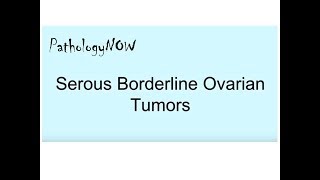 Pathology of Serous Borderline Ovarian Tumors [upl. by Aelsel]