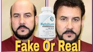 Refollium results  Regrow results  refollium review  dont buy [upl. by Eilrebma475]