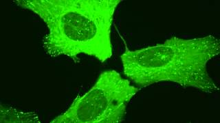 Microtubule dynamics in a living human cell [upl. by Slavin484]