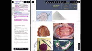 شرح prosthodontics lec 5 impression material and techniques for RPD طب اسنان مرحله رابعه [upl. by Ellehcrad]