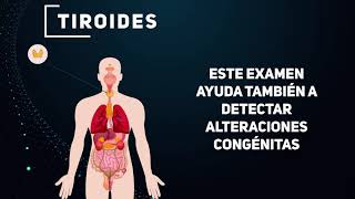 ¿Cuándo realizarte un Eco de Tiroides  SALUD GINECOLÓGICA [upl. by Dusen]