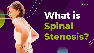 What is Spinal Stenosis [upl. by Okimuy670]