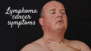 LYMPHOMA CANCER SYMPTOMS [upl. by Ehtyaf]