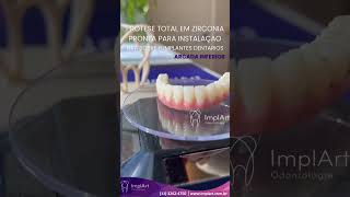 PROTESE PROTOCOLO ZIRCONIA  PRÓTESE FIXA INSTALADA SOBRE 6 IMPLANTES DENTARIOS implantesdentarios [upl. by Batista]