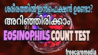 Eosinophils count test malayalam  allergy test  skin disease [upl. by Gio]