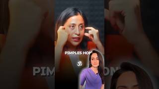 Acne face mapping  can acne show problems in internal organs  dermatologist comments [upl. by Ahserak856]