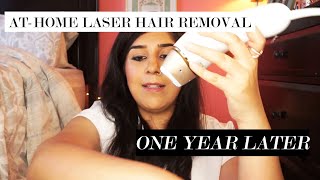 I DID ATHOME LASER HAIR REMOVAL FOR A YEAR  MY EXPERIENCE  FINAL VERDICT [upl. by Yenial]