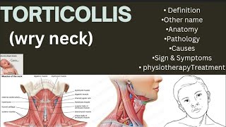 Torticollis wry neckDefinition Other nameAnatomyPathology CausesSignampSymptomsPhysiotherapy [upl. by Fiore37]