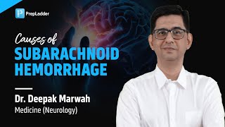 Causes of Subarachnoid Hemorrhage by Dr Deepak Marwah [upl. by Jerusalem]