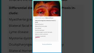 Causes of Bilateral Ptosis [upl. by Ococ]