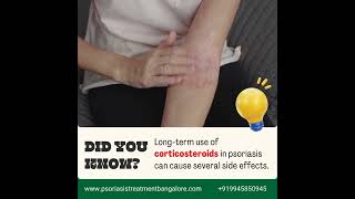 Longterm use of corticosteroids for psoriasis can lead to several side effects psoriasis [upl. by Tran]