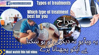 which types of treatment are best for you ll Detailed video ll ExPhysiologist [upl. by Kallman]