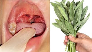 Cuts Cough Like a Knife 💯 Expectorant 😷 Natural Antibiotic for Bronchitis and Pharyngitis ❗ Liver [upl. by Lenci]