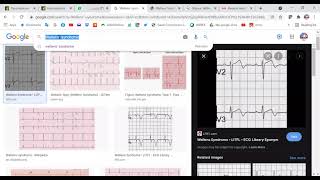 MRCP PART TWO PASSMEDICINE 2020 Cardiology 36 [upl. by Henke]