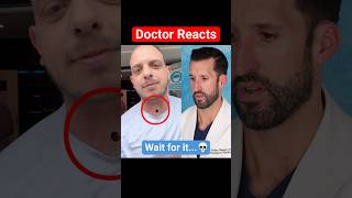 ER Doctor REACTS to Tracheostomy Hole [upl. by Belia]