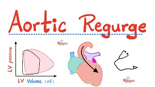 Aortic Regurgitation AR  Aortic Insufficiency  Valvular Heart Disease VHD  Cardiology [upl. by Ainafets816]