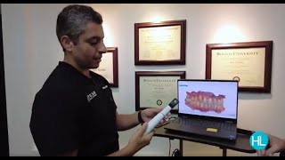 See how a One Arch dental implant is made [upl. by Ladnik]