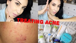 Daily Skin Care Routine ♥ Get Rid Of Acne amp Scars [upl. by Pollie]