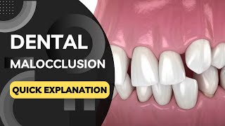 What is Dental Malocclusion Quickly Explained in a Few Seconds [upl. by Aryek376]