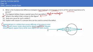 31 A What is the fundamental difference between hypermetropia and myopia in terms of the optical [upl. by Iramat]