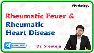 6 Rheumatic Fever and Rheumatic heart disease  Pathology USMLE Step 1 [upl. by Ainezey]