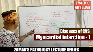 Systemic Pathology Lecture 35  Diseases of CVS  Day 05  Myocardial infarction  01 [upl. by Bernadina]