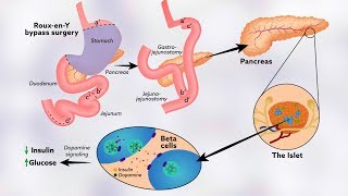 How tyrosine might help regulate glucose levels [upl. by Oruhtra]