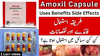 Amoxil Capsule Uses In Urdu  Amoxil Capsule 500mg  Amoxil Capsule 250 mg [upl. by Channa]