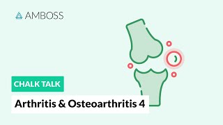 Arthritis amp Osteoarthritis  Part 4 Joint Involvement Patterns in Rheumatic Diseases [upl. by Recha445]