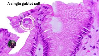 Pro tip alert 🔍🌈 how to identify goblet cells in Barretts esophagus Focus on this mucosa [upl. by Arahd]