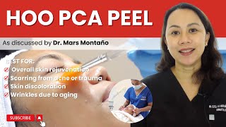 PCA SKIN PEEL [upl. by Esinned]