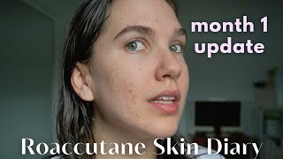 Roaccutane Daily Skin Diary  Taking Accutane For A SECOND Time  Month 1 [upl. by Jepum]