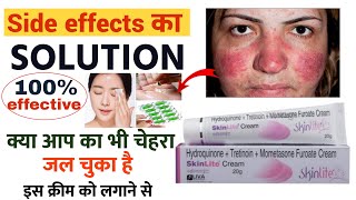 skin light cream के साइड इफेक्ट को ऐसे ठीक करें  skinlite cream side effects ko kaise thik kare [upl. by Meingoldas]