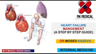 Heart failure Management [upl. by Kristel]