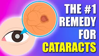 1 REMEDY for Cataracts in 2024 Updated [upl. by Rafael]