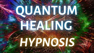 Accessing Higher Wisdom Quantum Healing Hypnosis Session [upl. by Anahc]