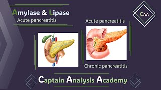 E2acute pancreatitis Amylase amp Lipase انزيمات البنكرياس الاميليز والليبيز [upl. by Berthoud904]