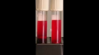 Preventing Hemolysis in the Blood Samples You Draw [upl. by Ytisahc]