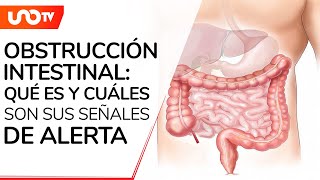 Oclusión intestinal ¿qué es el padecimiento que sufrió Ignacio López Tarso antes de morir [upl. by Jay]