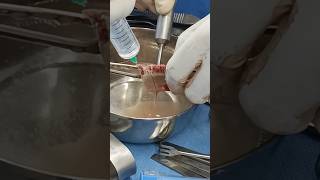 Cutting a bone for jaw replacement procedure [upl. by Scrope757]