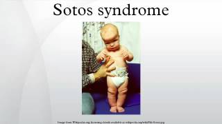 Sotos syndrome [upl. by Tsepmet647]