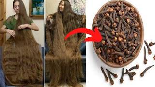 Cloves For Hair Growth Use Cloves To Get Thicker Hair In Less Than 30 Days 🤫 Long Hair Care [upl. by Averill]