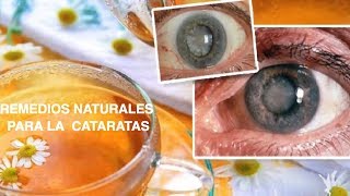 REMEDIOS Naturales PARA LAS CATARATAS [upl. by Cardew]